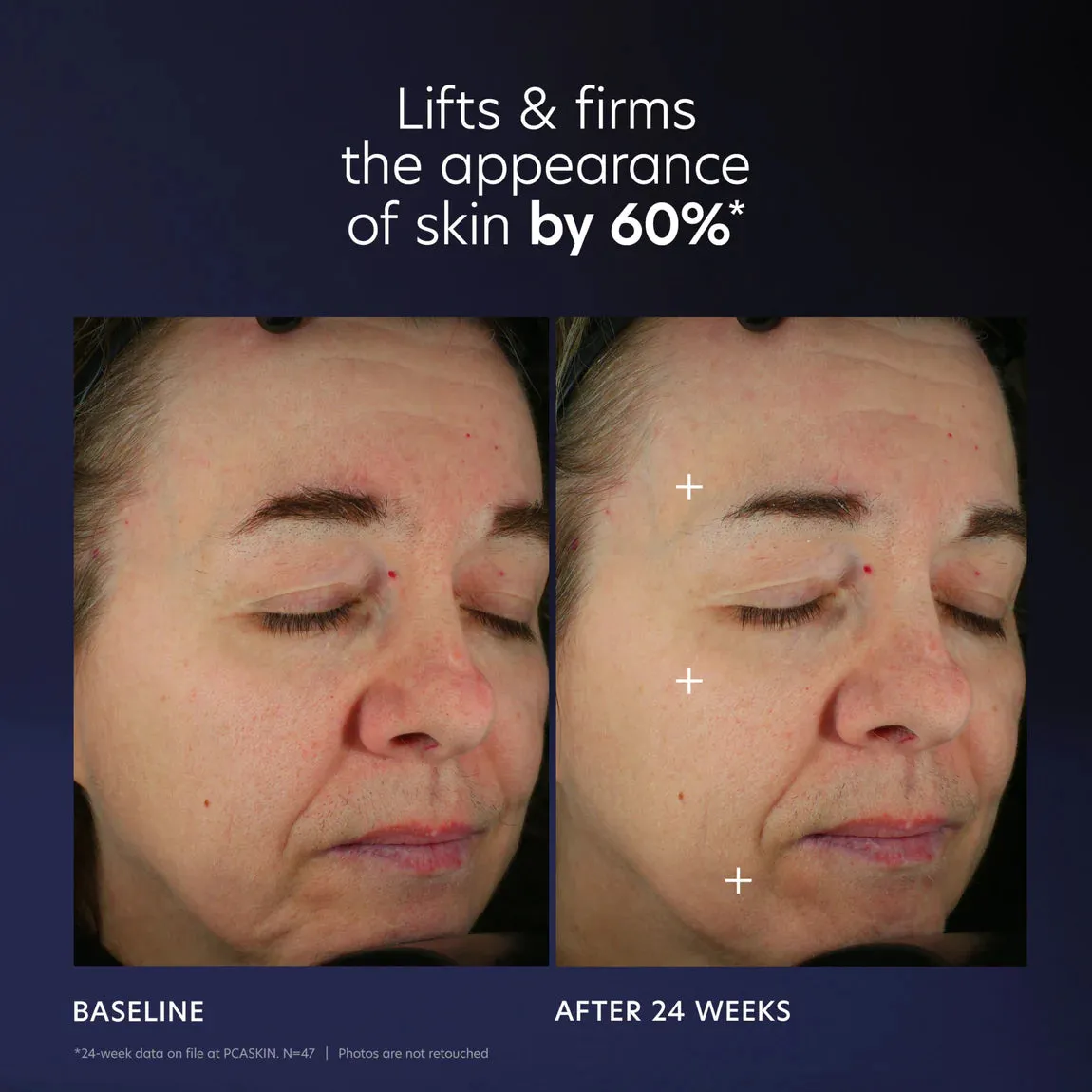 PCA Skin Pro-Max Age Renewal